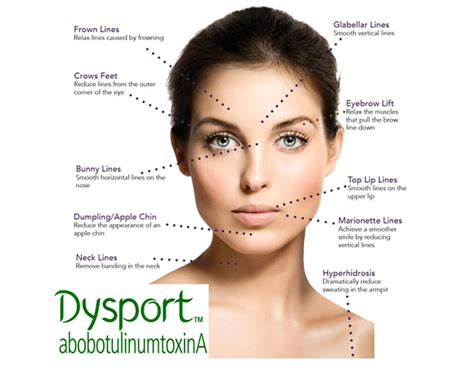 dysport|dysport website.